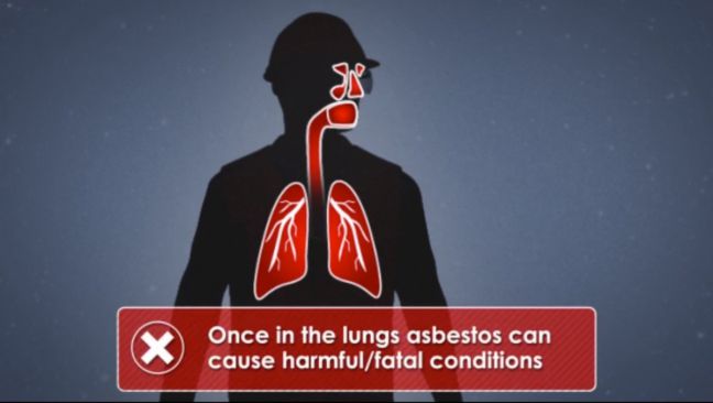 Asbestos in Lungs Image