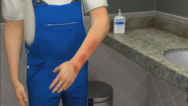 First Aid – Animal and Human Bites and Scratches for Schools